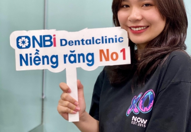 Thời gian niềng răng mất bao lâu?