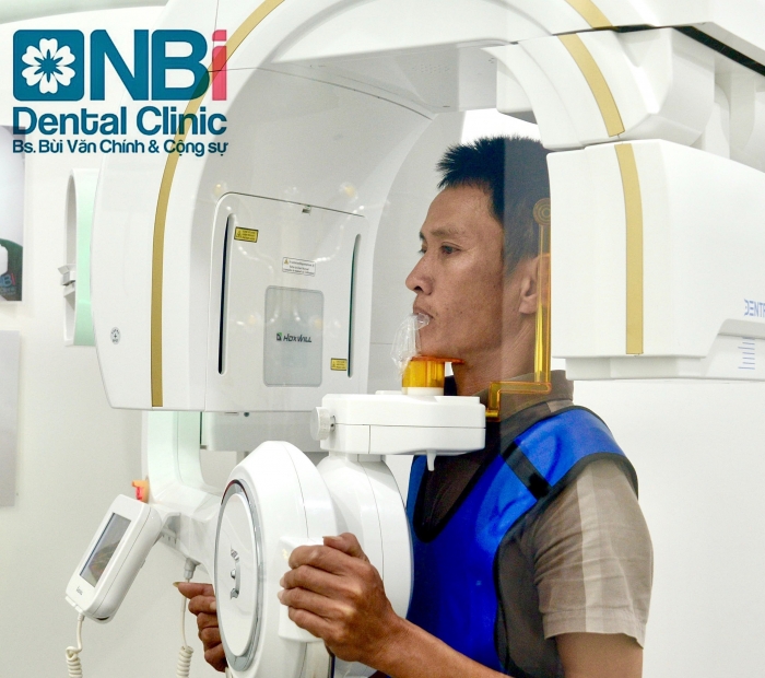 Chụp phim X quang CT Cone Beam 3D hiện đại tại NBI.